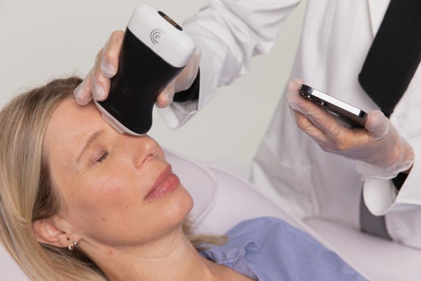 Clarius L20 (8-20mHz, 4cm)– Ultra High Frequency bežični portabilni ultrazvuk za estetsku medicinu, facial mapping i ultrazvučno vođene injekcije