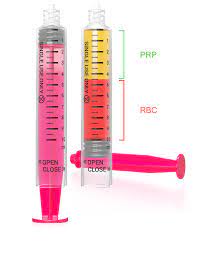 T-LAB NEXT PRP ŠPRICA 3-u-1-PRP epruveta koja se pretvara u PRP špricu