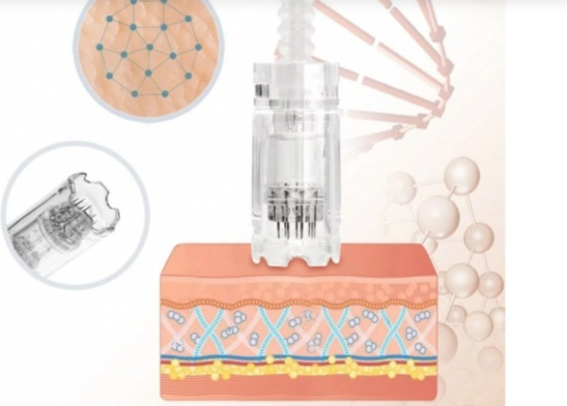 DERMAPEN Dr.Pen ULTIMA A10 – Profesionalni dermapen za microneedling