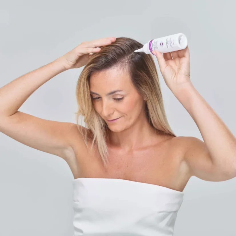 CEBELIA ANTI‑HAIR LOSS LOTION 1x60 ml – Profesionalni tretman za smanjenje opadanja i poticanje rasta kose