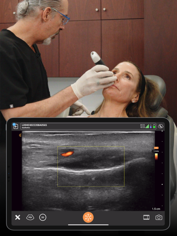 Clarius L20 (8-20mHz, 4cm)– Ultra High Frequency bežični portabilni ultrazvuk za estetsku medicinu, facial mapping i ultrazvučno vođene injekcije