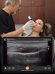 Clarius L20 (8-20mHz, 4cm)– Ultra High Frequency bežični portabilni ultrazvuk za estetsku medicinu, facial mapping i ultrazvučno vođene injekcije
