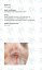Botulinum Toxin In Aesthetic Medicine - Pocket Guide - Numerous "cheatsheets" and tips & tricks for quick orientation and safe BTX injections