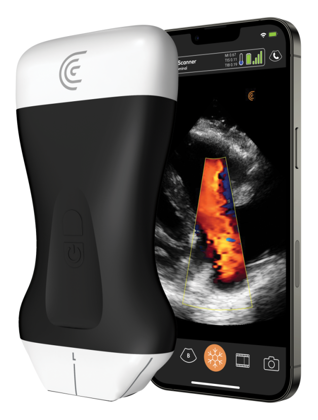 Clarius L20 (8-20mHz, 4cm)– Ultra High Frequency bežični portabilni ultrazvuk za estetsku medicinu, facial mapping i ultrazvučno vođene injekcije