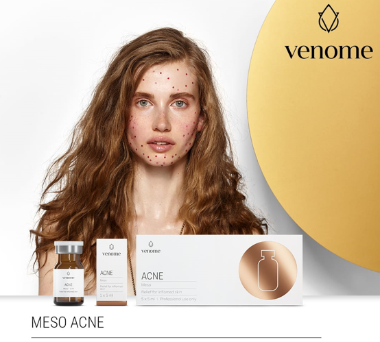 VENOME MESO ACNE 5x5ml - Profesionalna terapija za aknama sklonu i upaljenu kožu